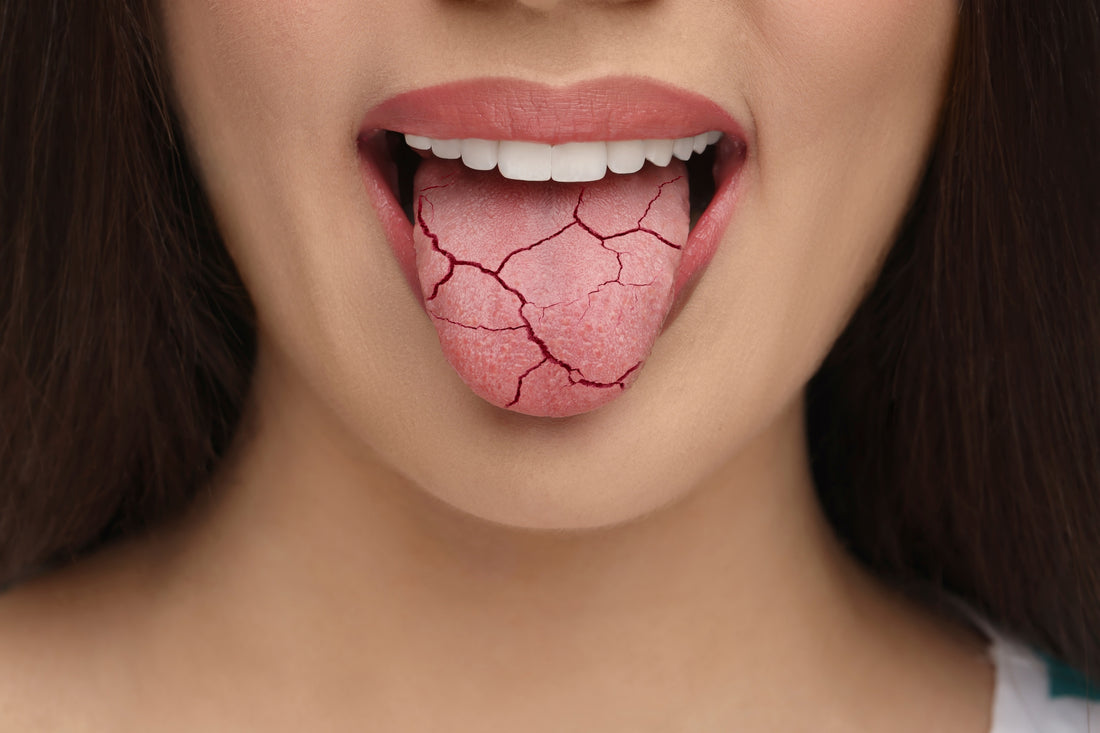 Dry Mouth Causes, Symptoms, and Remedies Guide