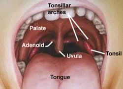 Tonsil stones being pointed out in the back of the mouth