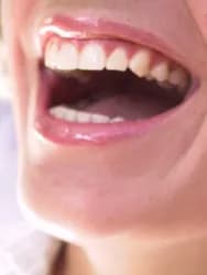 Closeup of mouth smiling with teeth showing