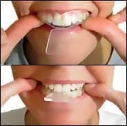 Place the trays over your upper and lower teeth one at a time