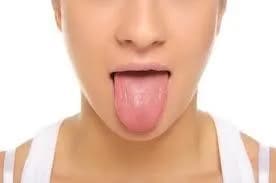 lady with chronic halitosis caused by dry mouth