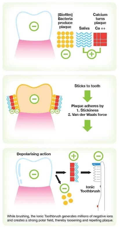 Ionic Proclean Toothbrush illustration